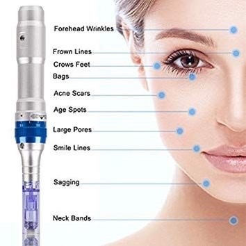 Graphic of face and neck treatment areas for Nano Infusions.